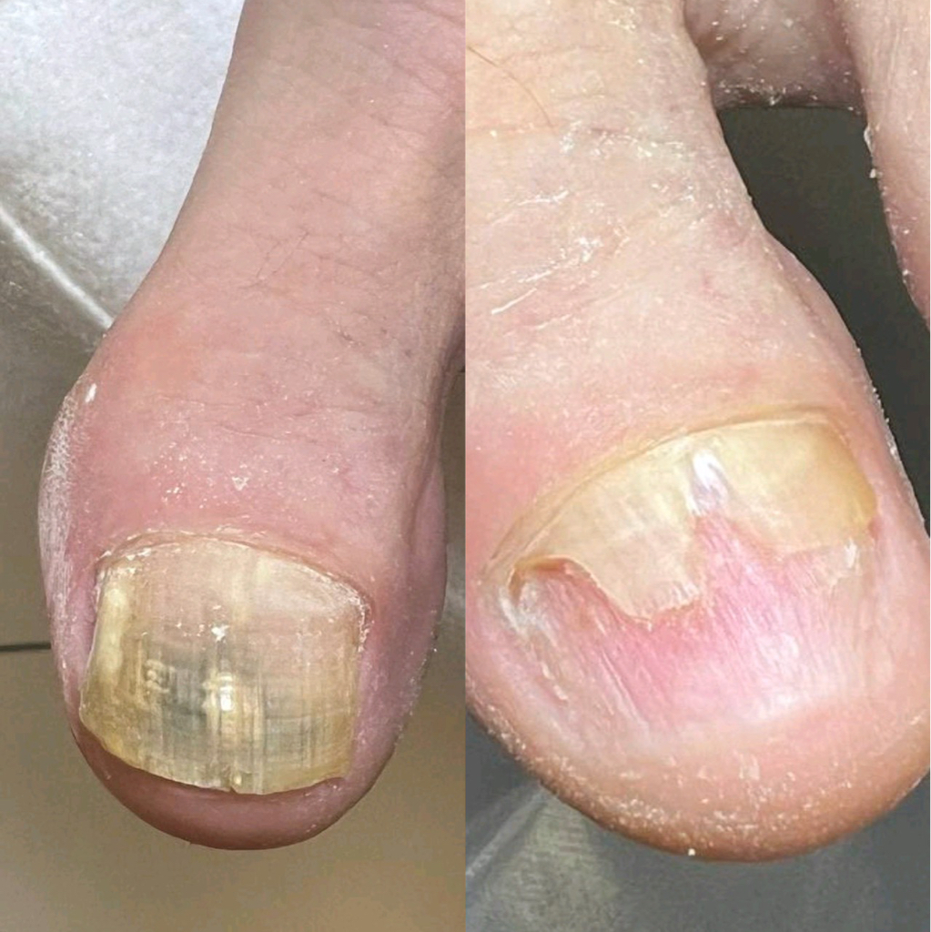 Мужской педикюр полный