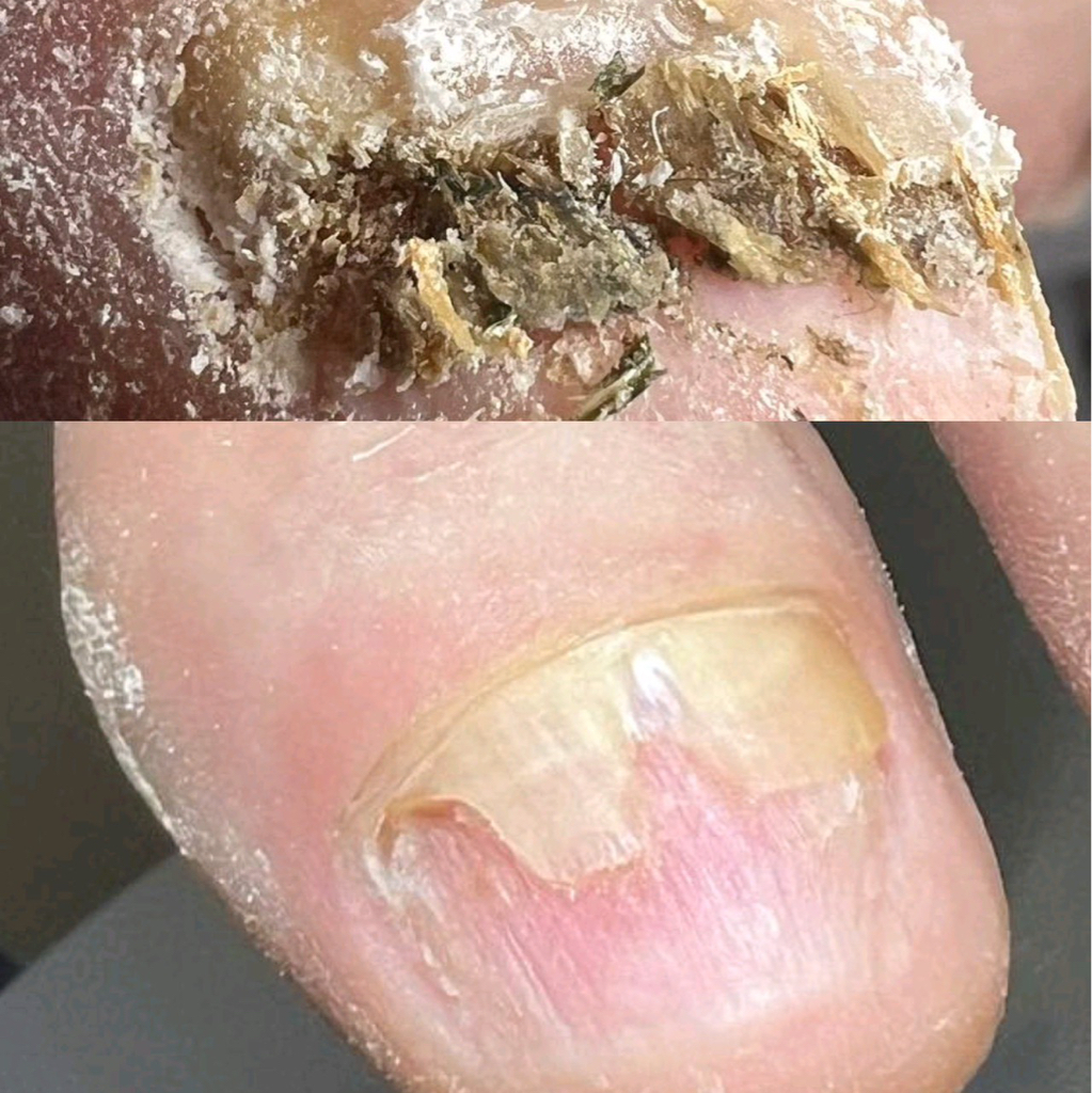 Подологические услуги