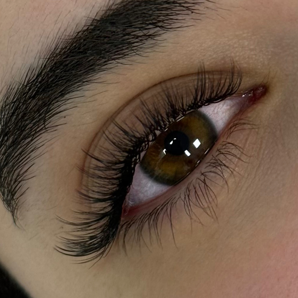 Добавление лучей