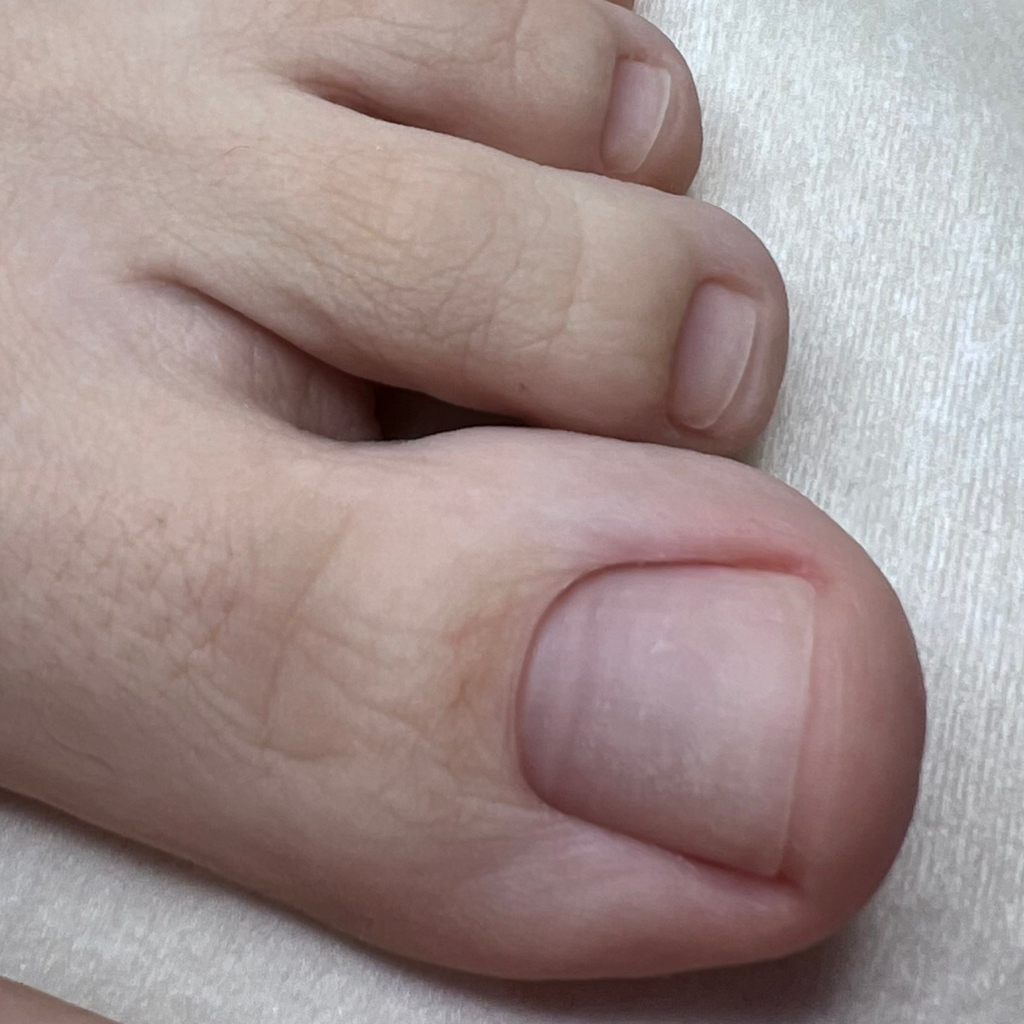 Обработка пальчиков (гигиена)