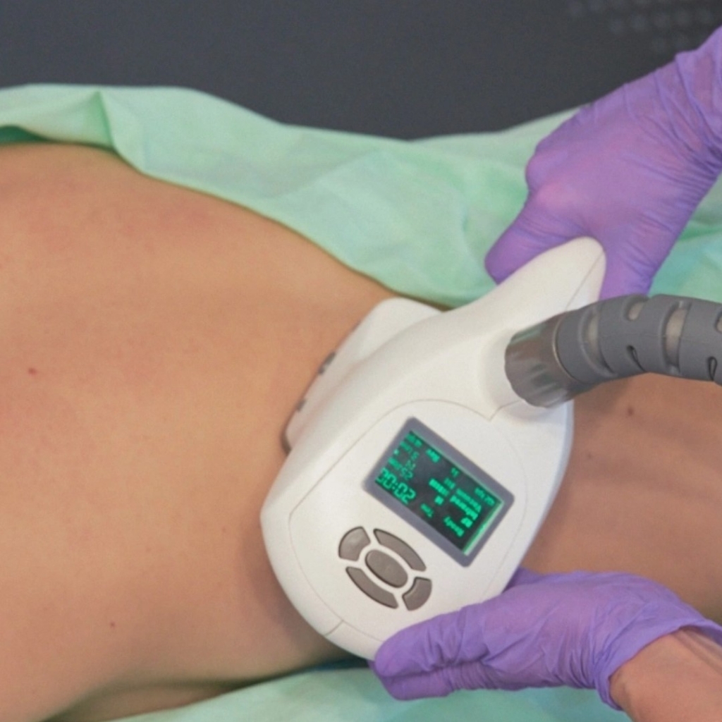 RF лифтинг тела