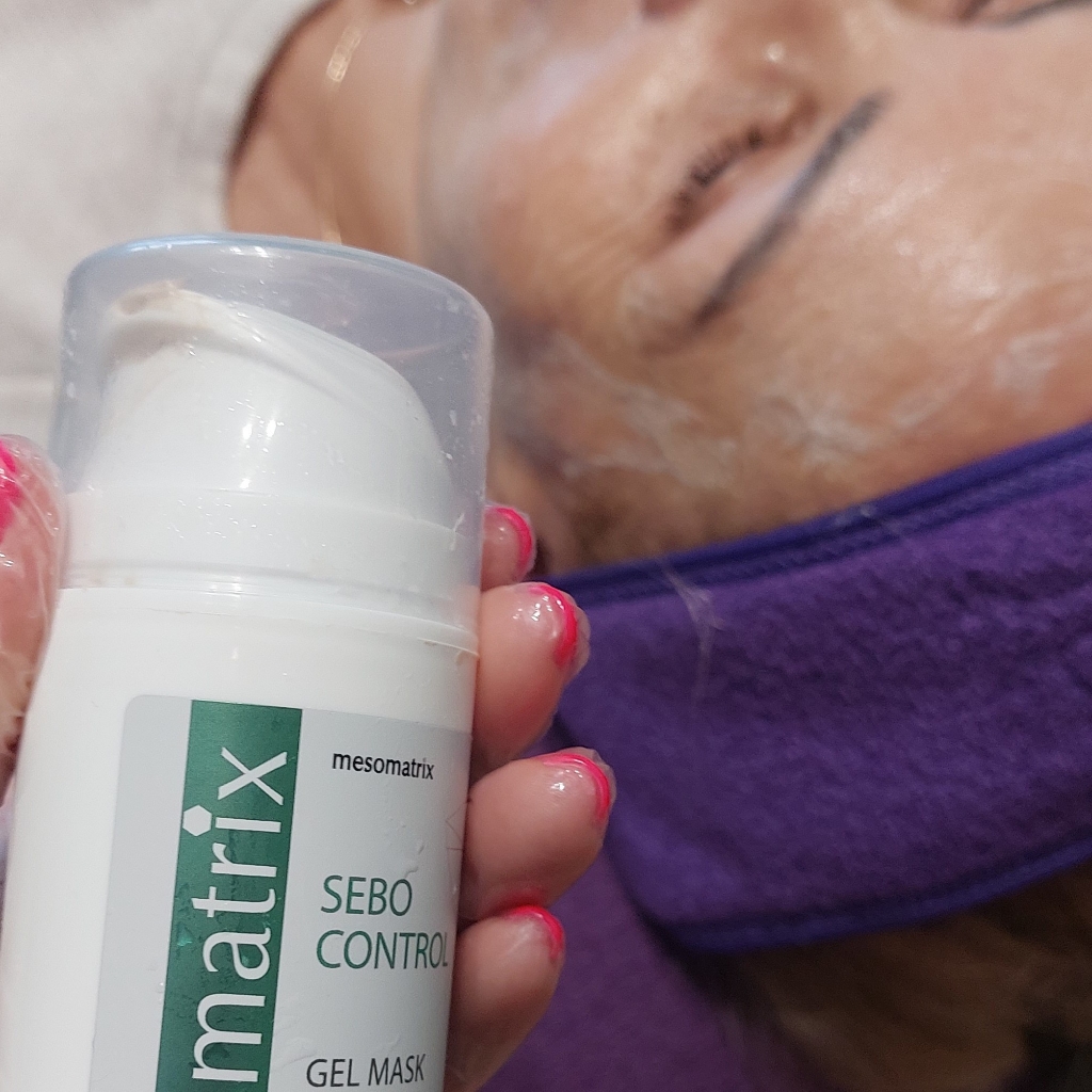 Карбокситерапия