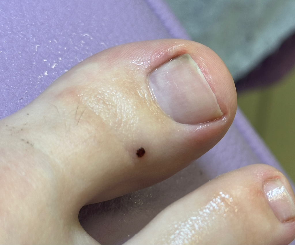 Коррекция длины на ногах