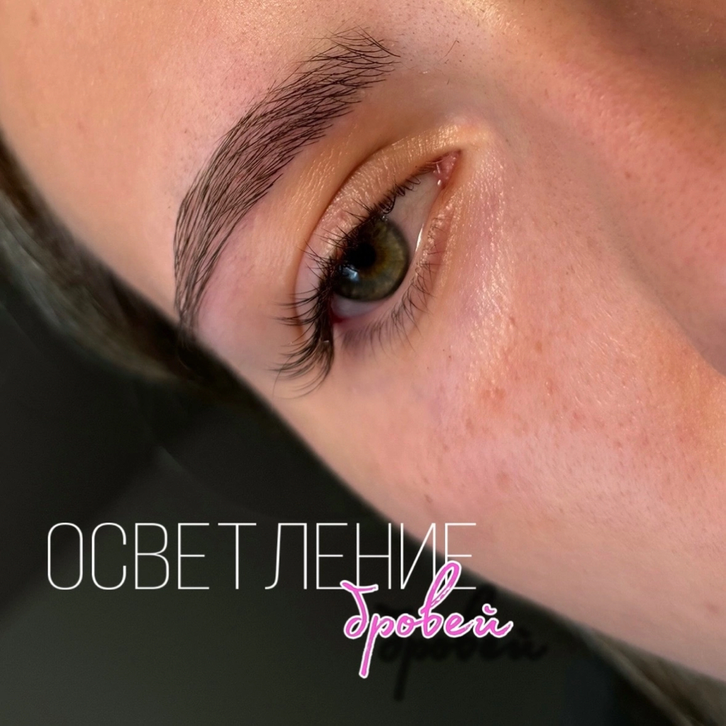 Сложная коррекция/структурная коррекция/прореживание