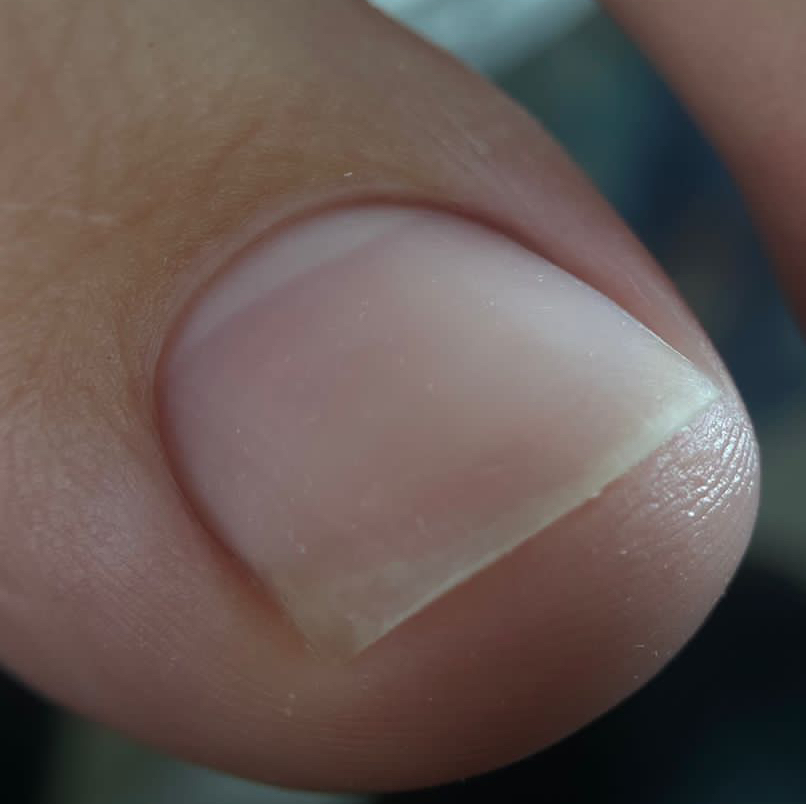 Аппаратный педикюр