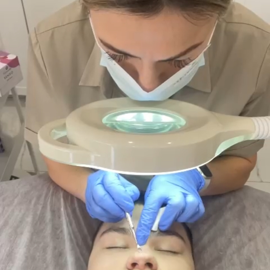 Чистка лица комбинированная. Глубокое очищение кожи.