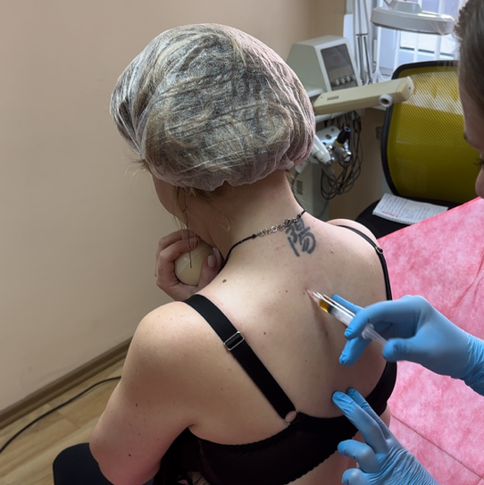 КапилляроМезоТерапия (КМТ)