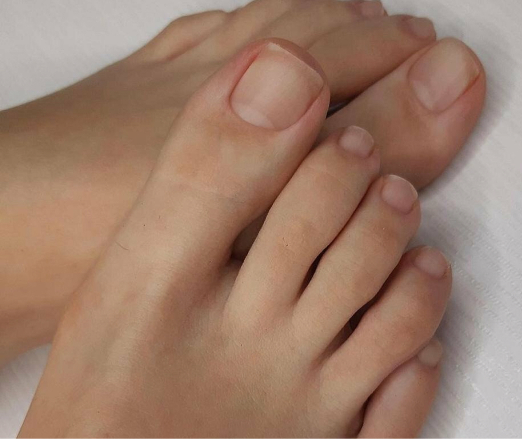 Обработка пальчиков