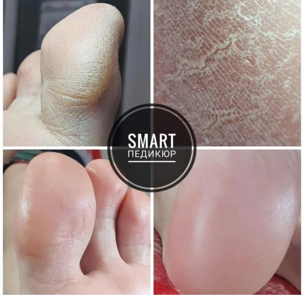 Smart педикюр