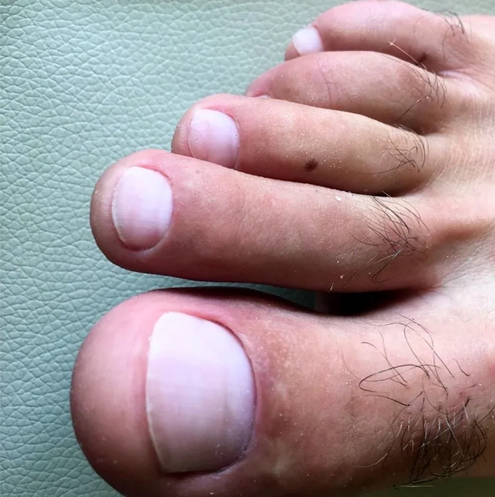 Обработка пальчиков мужской