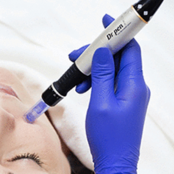 Фракционная мезотерапия