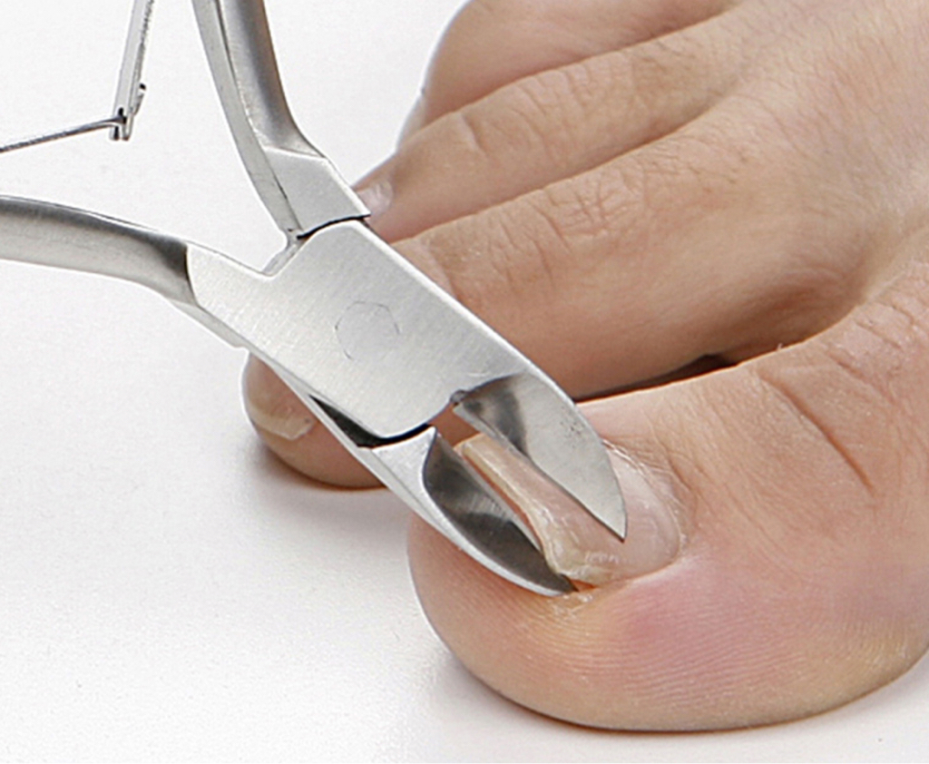 Стрижка ногтей на ногах