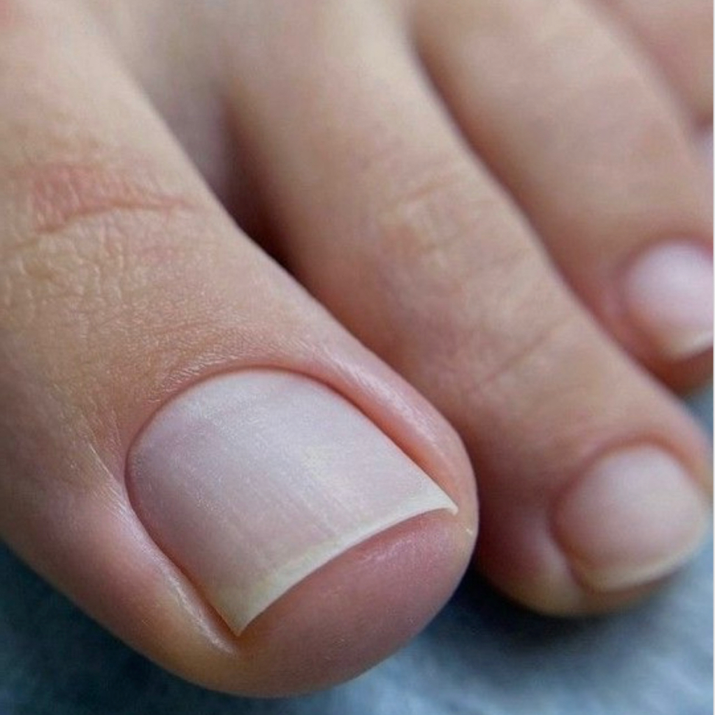 Педикюр пальчики