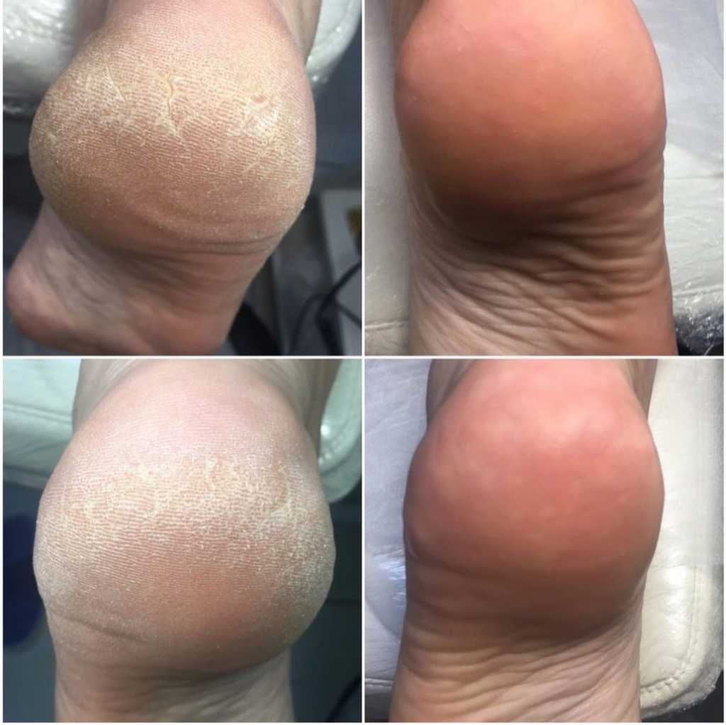 Педикюр без покрытия