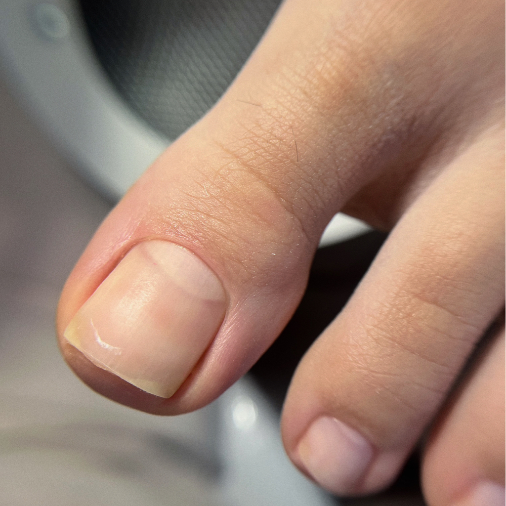 Педикюр обработка пальчиков