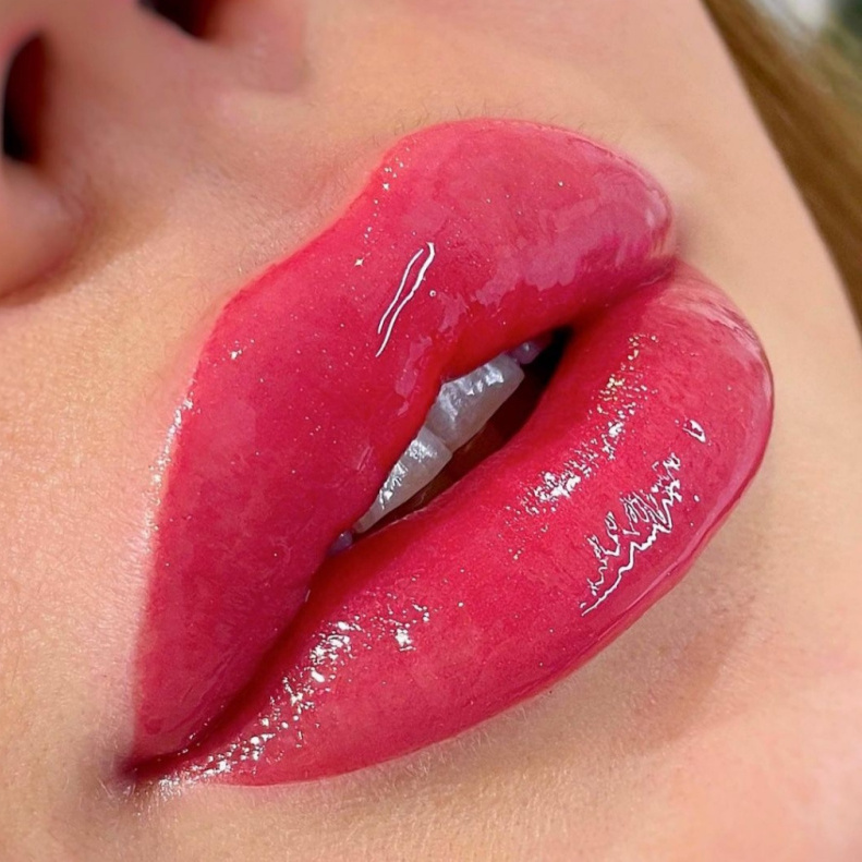 Коррекция ПМ (через 1-2 месяца)