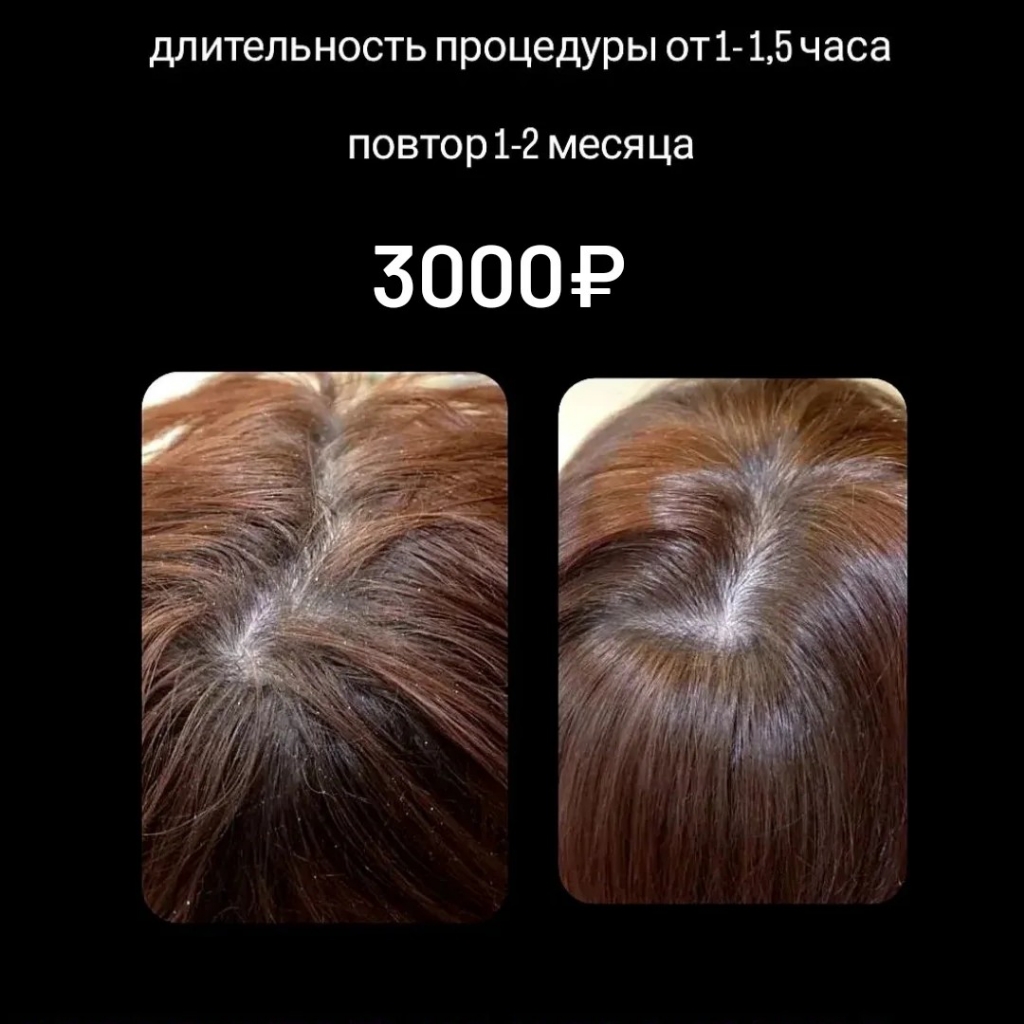Пилинг кожи головы + SPA уход за волосами