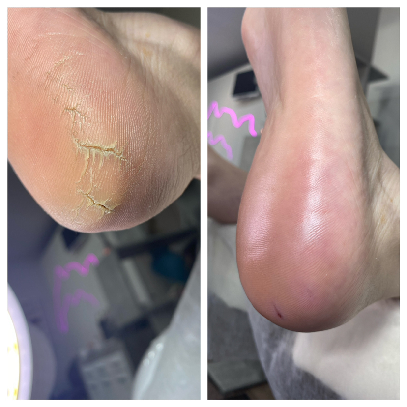 Smart-педикюр, гигиена, без покрытия