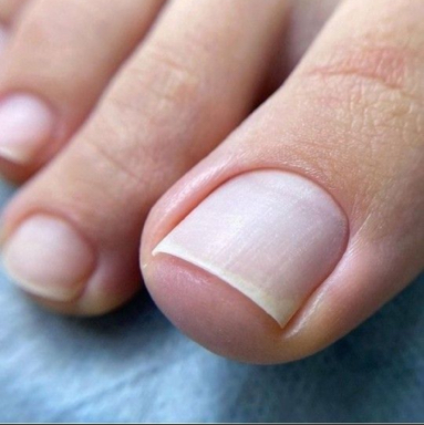 Педикюр пальчиков