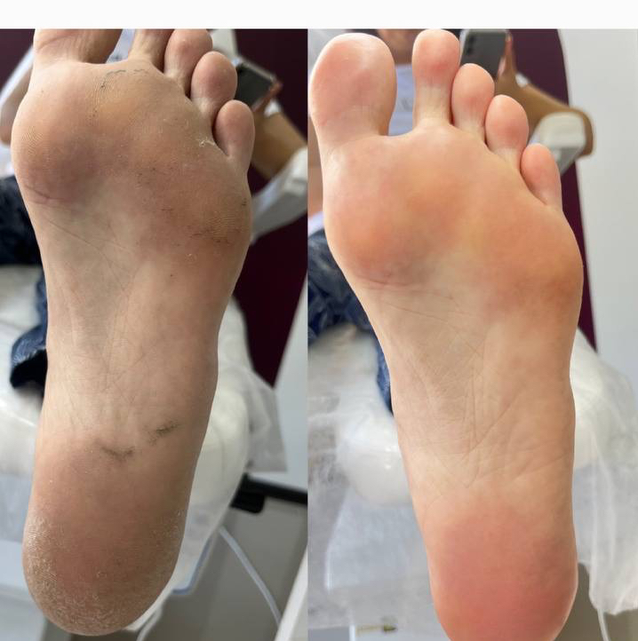 Педикюр  (полный )без покрытия