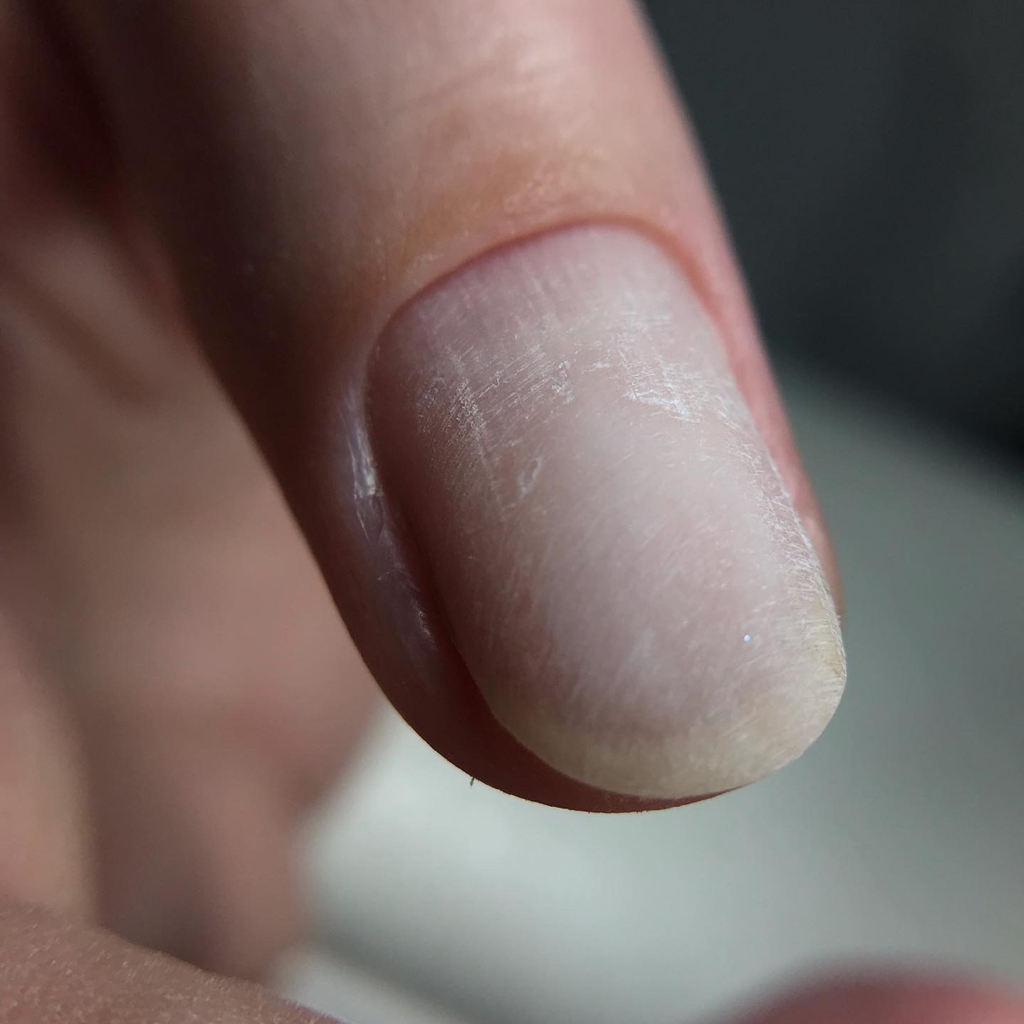 Гигиенический маникюр