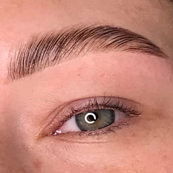 Brow Treatment