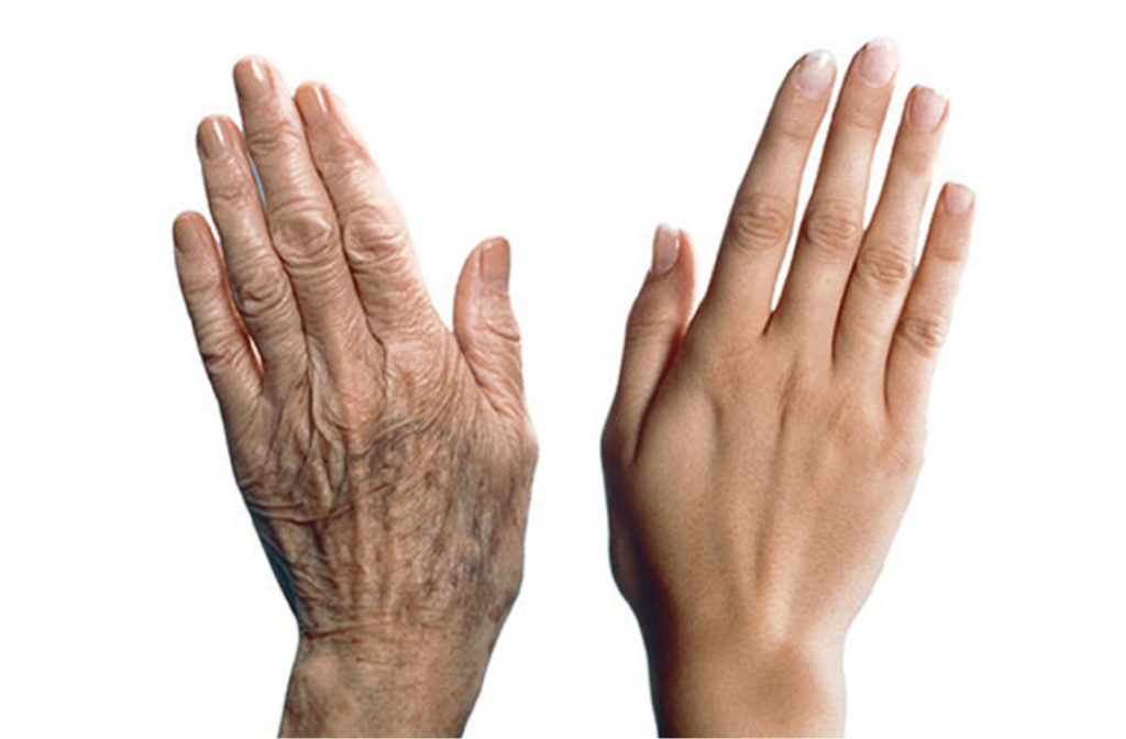 ГЛАДКИЕ РУКИ Пилинг ТСА
+набор кремов