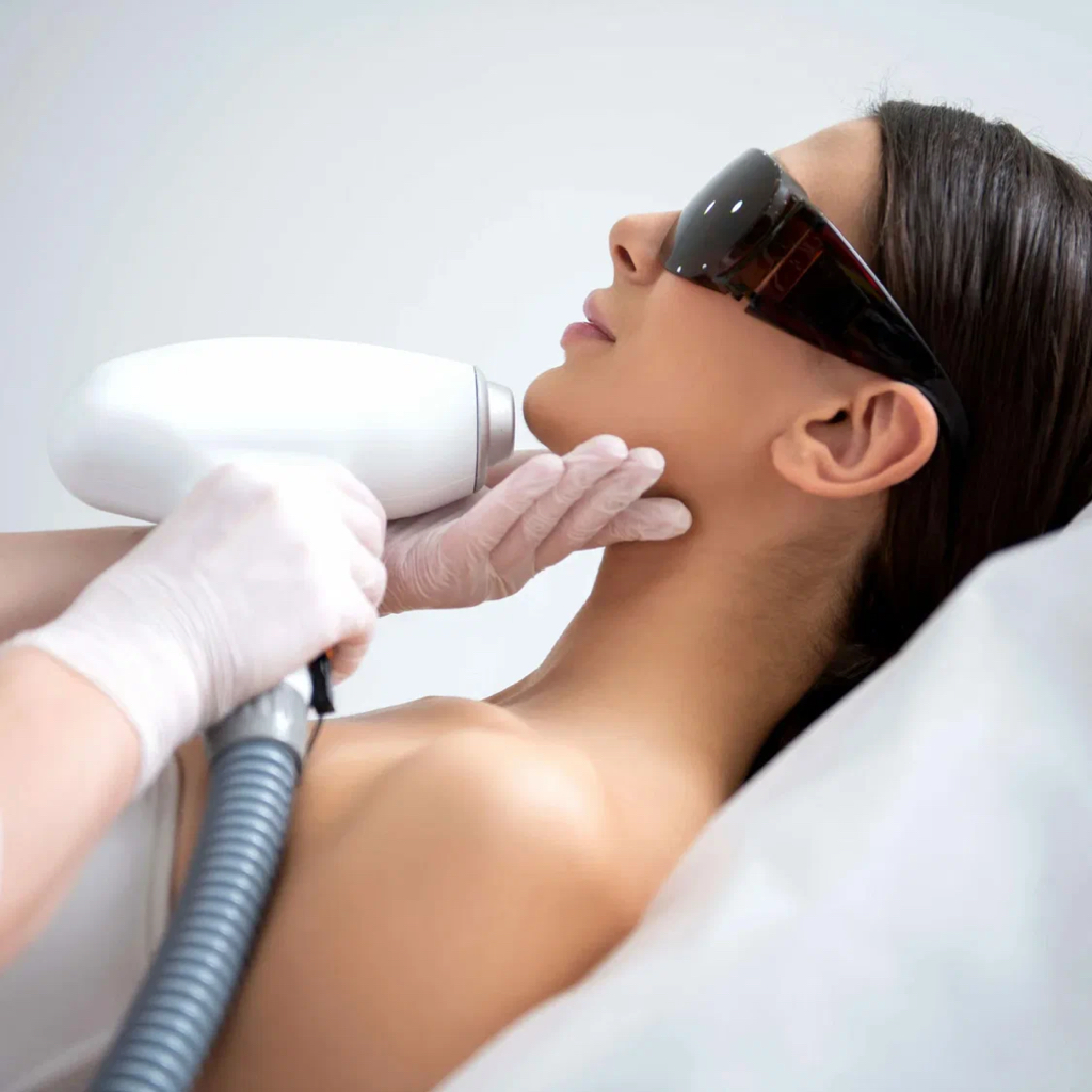 Лазерная эпиляция лоб