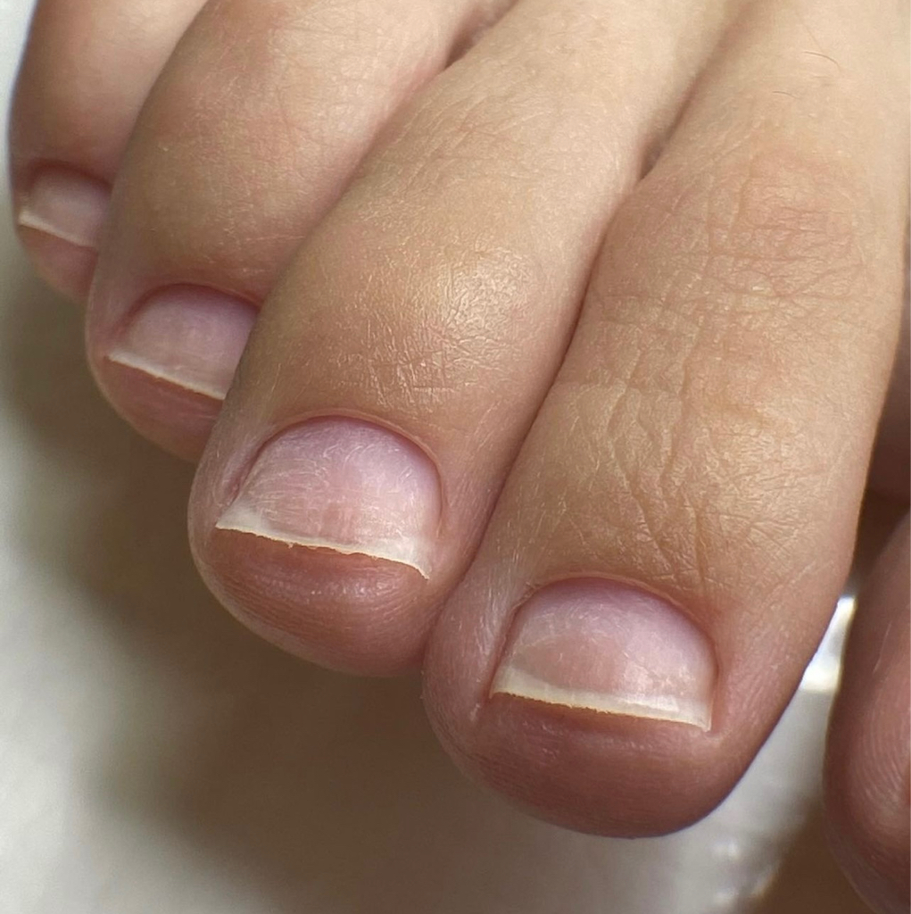 гигиенический педикюр без покрытия