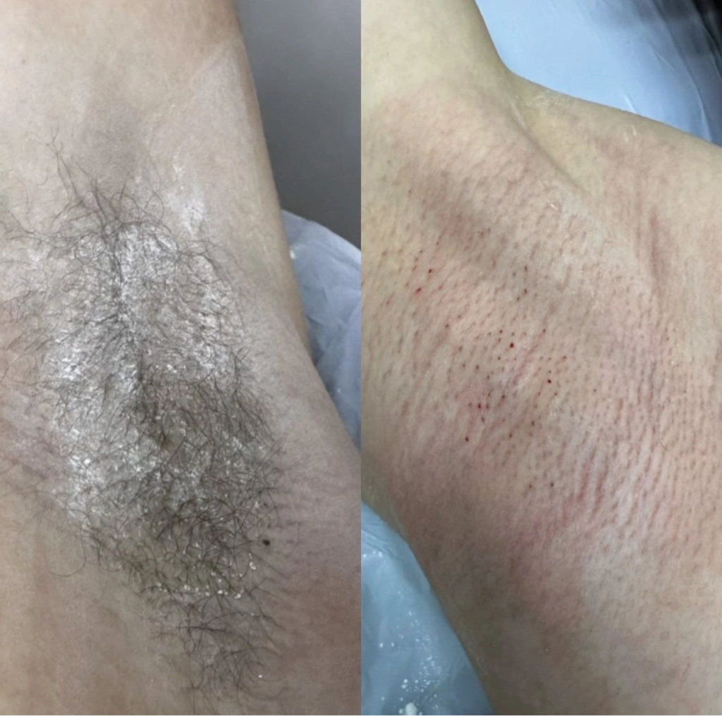 Подмышечные впадины