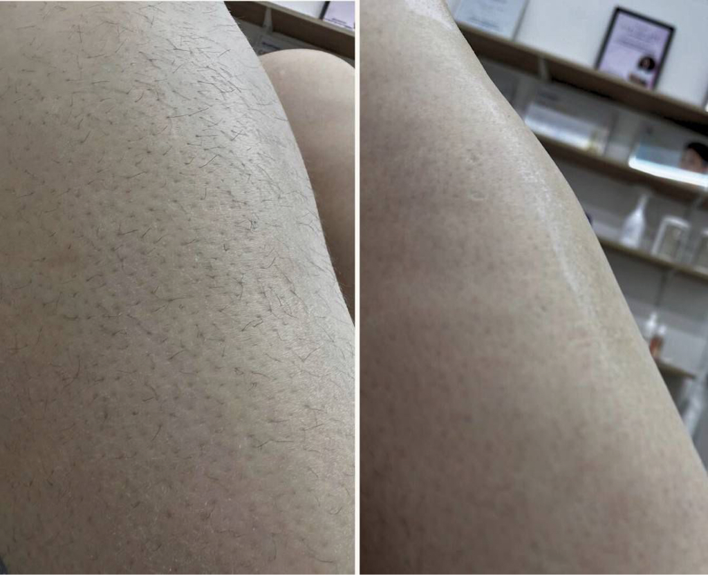 Ноги полностью