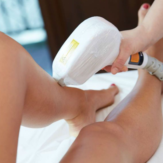 Лазерная эпиляция (ноги до колен)