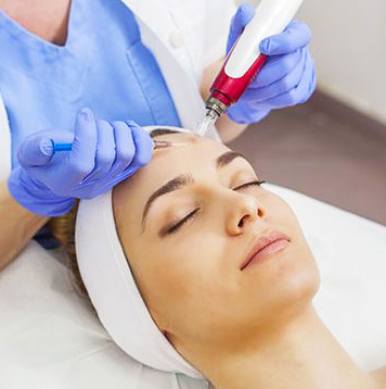 Фракционная мезотерапия