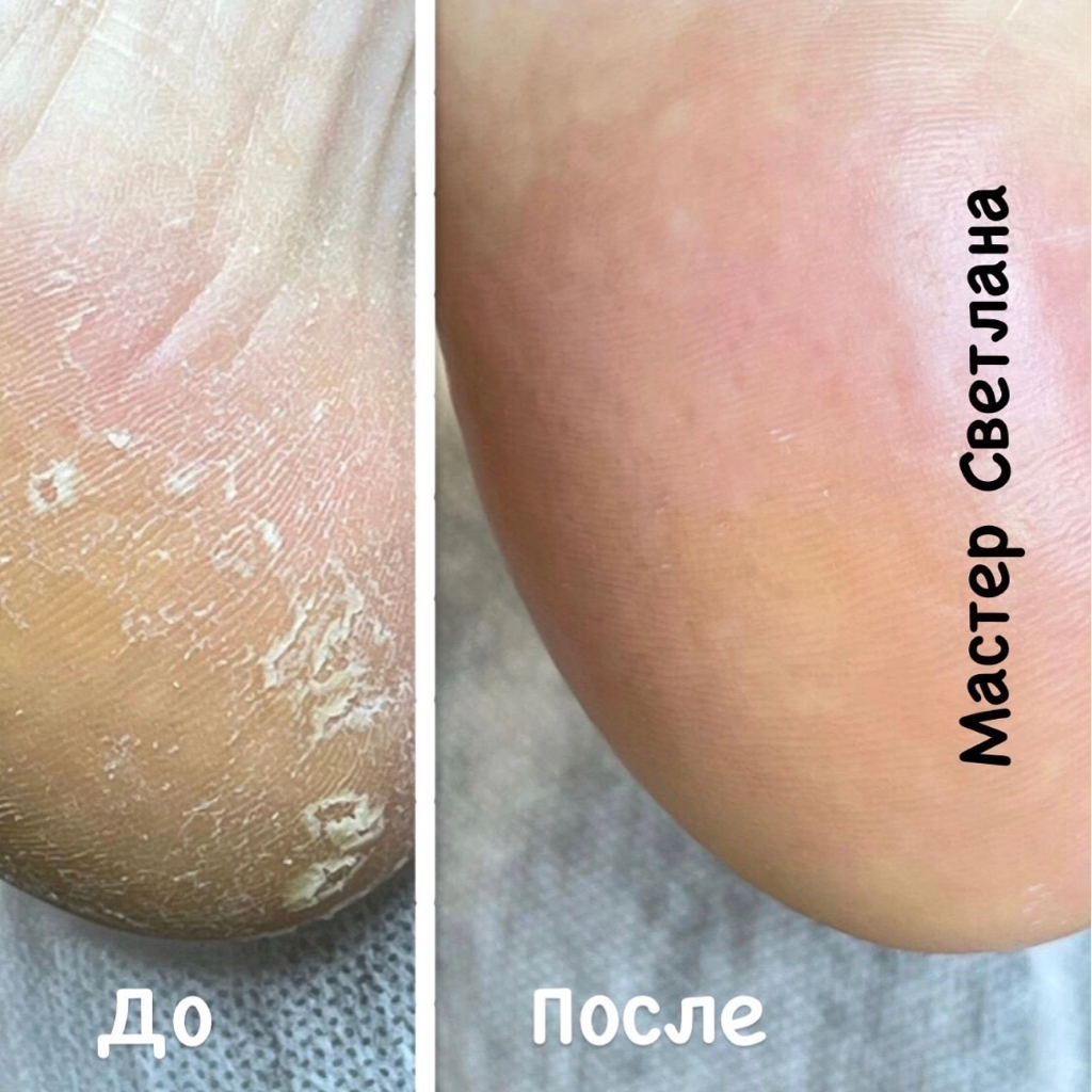 Женский педикюр обработка стоп и пальцев (без покрытия)