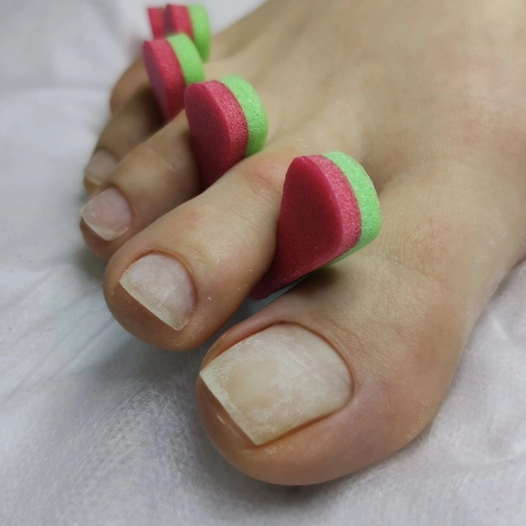 Обработка пальцев ног