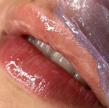 Депиляции воском над губой