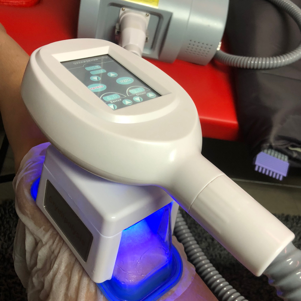 Криолиполиз