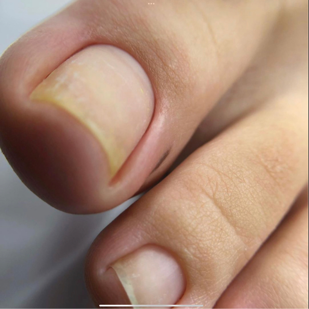 Комплекс «Педикюр NATUREL»