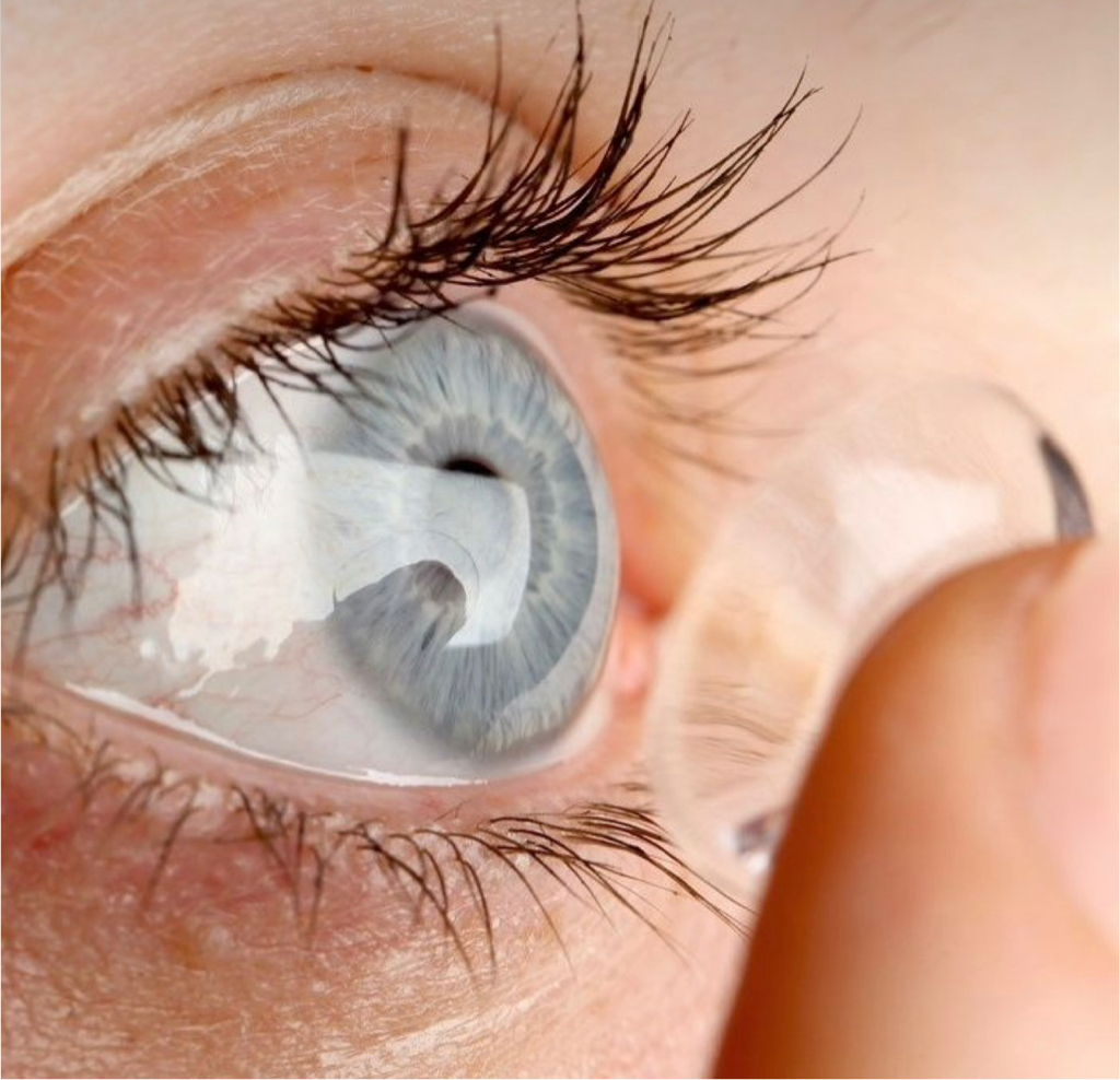 Подбор сферических мягких контактных линз для пациентов,  ранее носивших контактные линзы