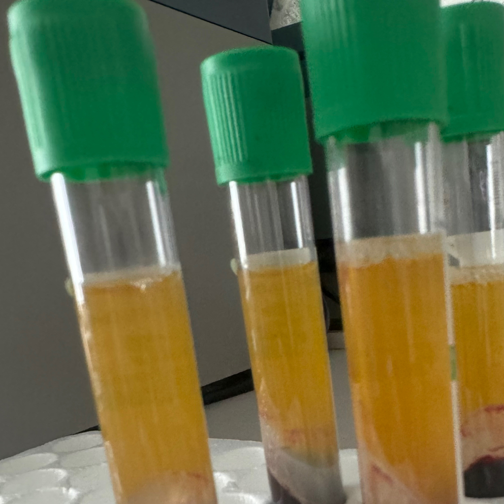 Плазмотерапия волосистой части головы