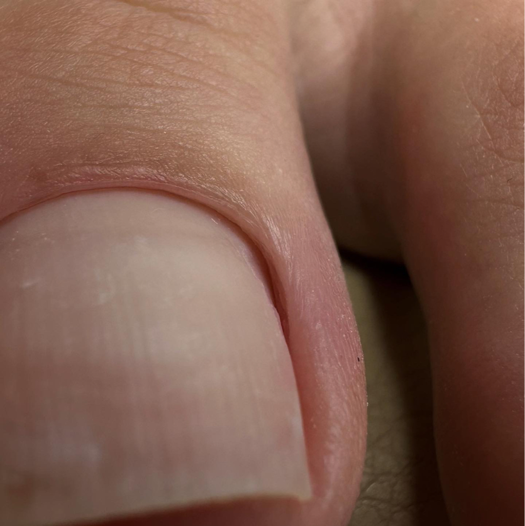 Снятие + педикюр