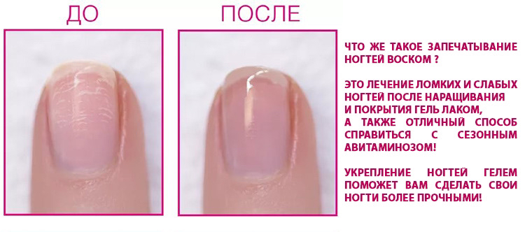 LSN система
