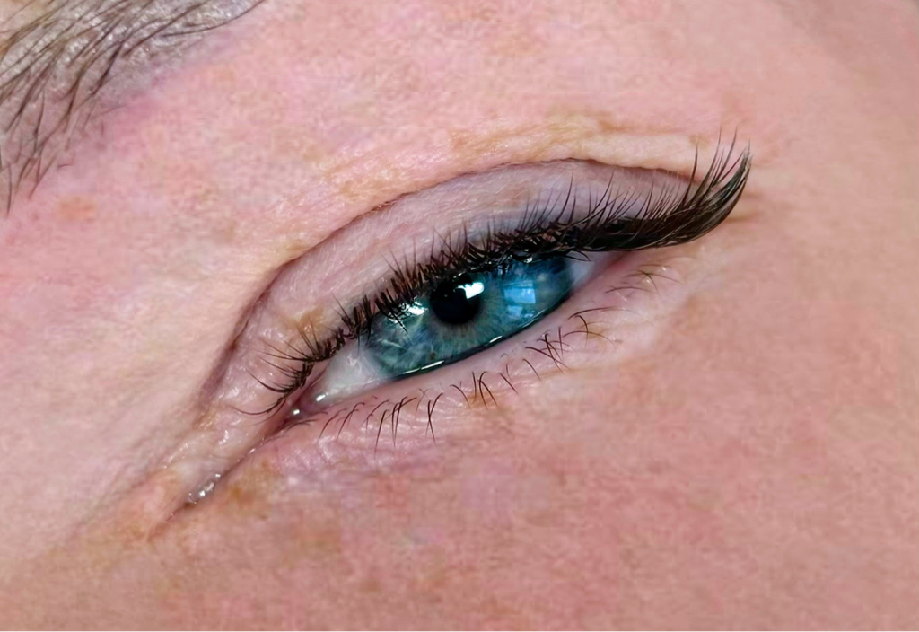 LED- Наращивание уголков