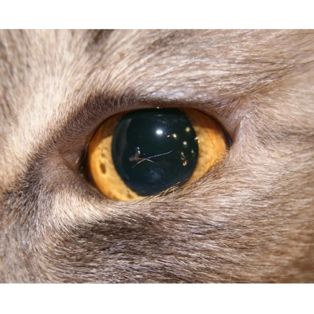 приём офтальмолога