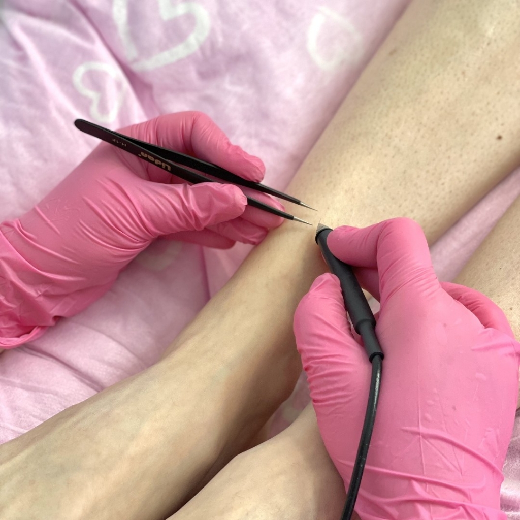 Пробная процедура 10 минут