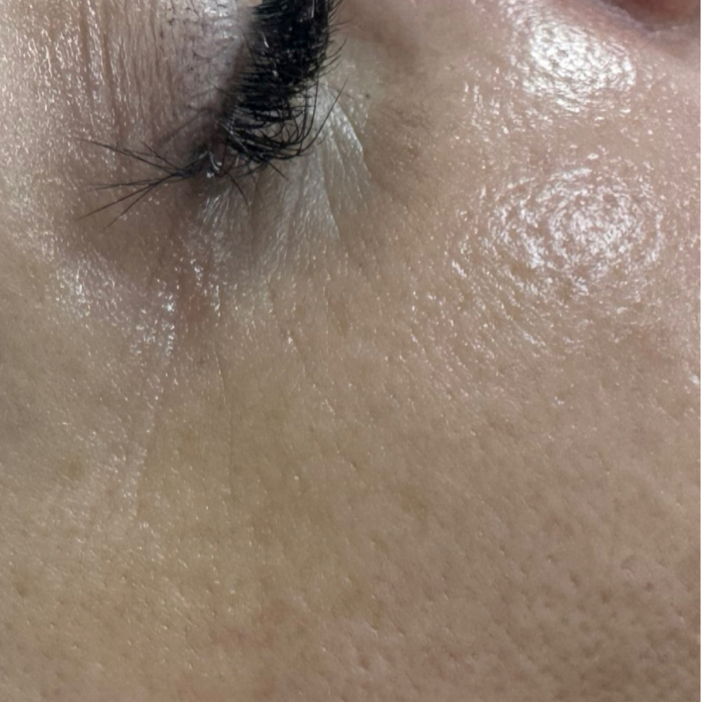 Уход за периорбитальной зоной