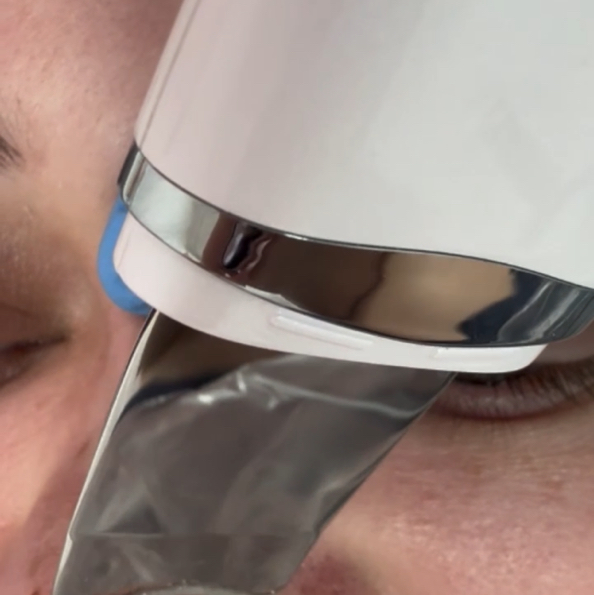 Неинвазивная биоревитализация лица ,шеи ,декольте.