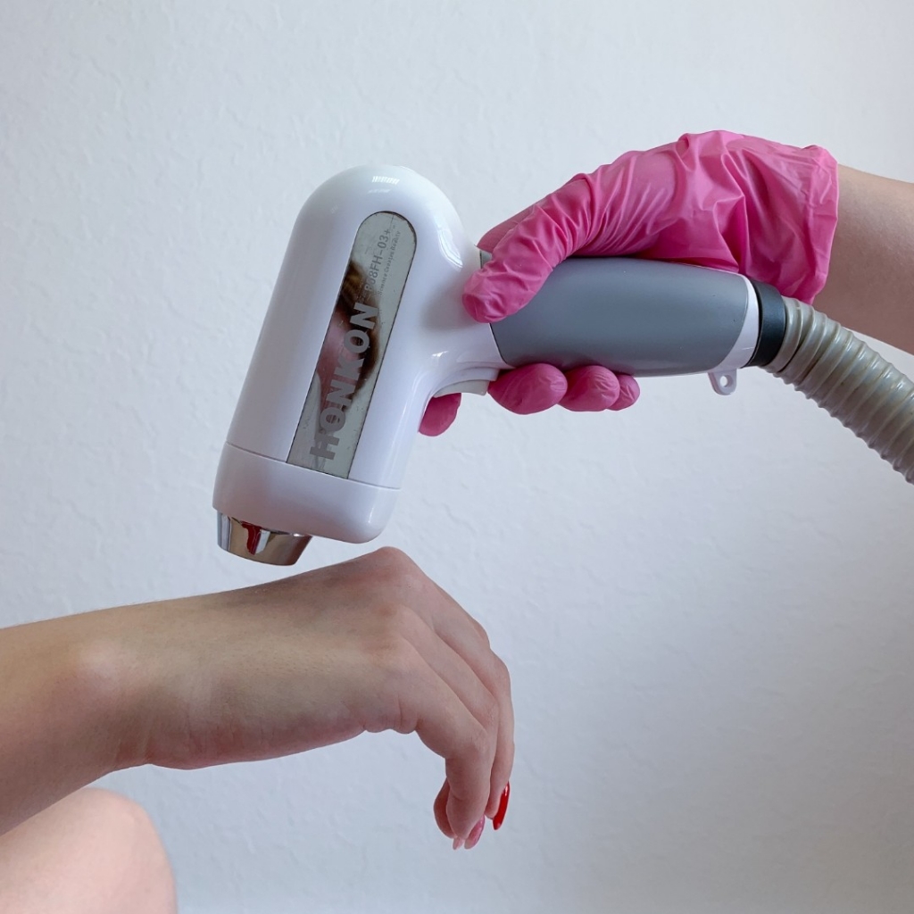 Лазер: руки полностью