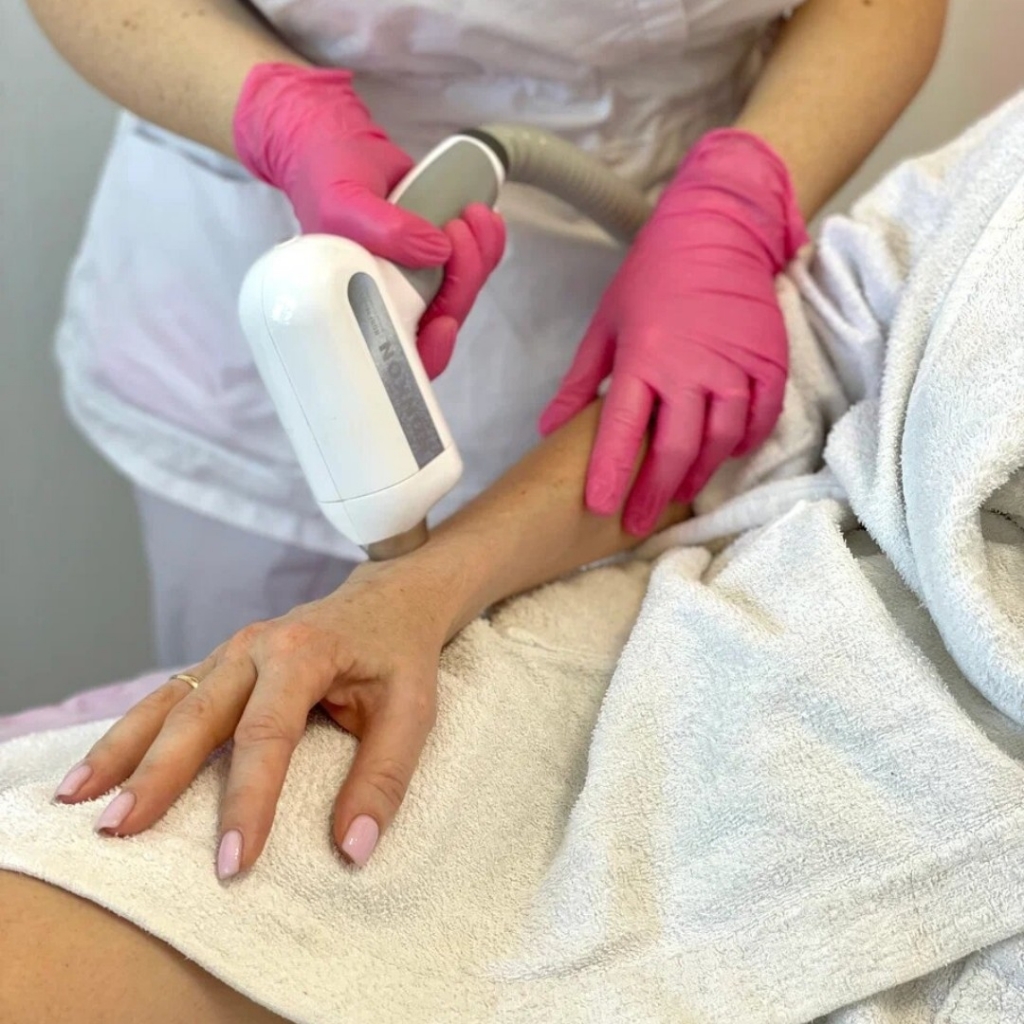 Лазер: руки до локтя