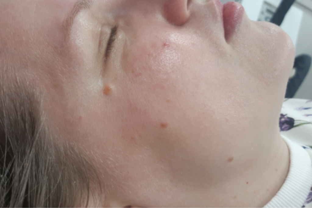 Уход за лицом для беременных и кормящих женщин.